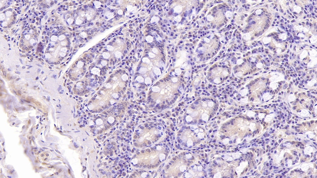 DNAH11 Antibody in Immunohistochemistry (Paraffin) (IHC (P))