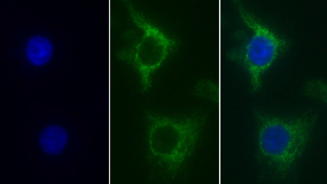 SDHA Antibody in Immunocytochemistry (ICC/IF)