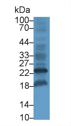HBEGF Antibody in Western Blot (WB)