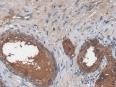 LGALS3BP Antibody in Immunohistochemistry (Paraffin) (IHC (P))