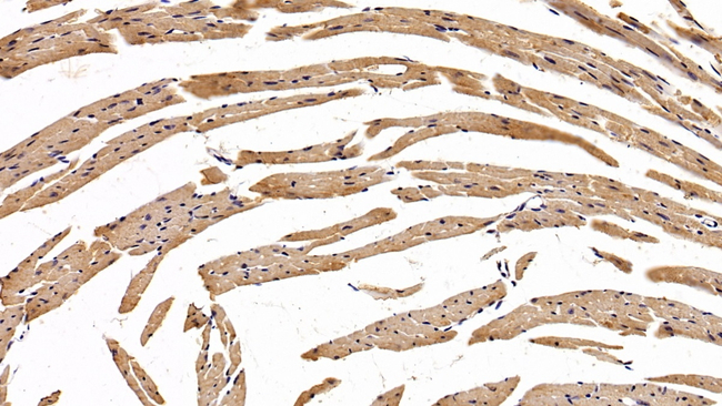 EpoR Antibody in Immunohistochemistry (Paraffin) (IHC (P))