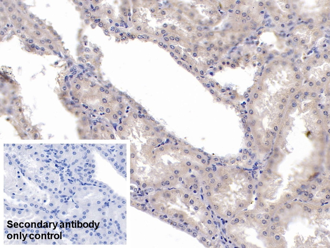 KPNA2 Antibody in Immunohistochemistry (Paraffin) (IHC (P))