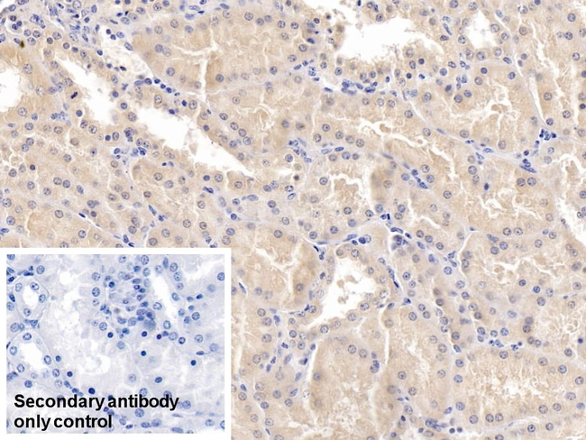 EB1 Antibody in Immunohistochemistry (Paraffin) (IHC (P))