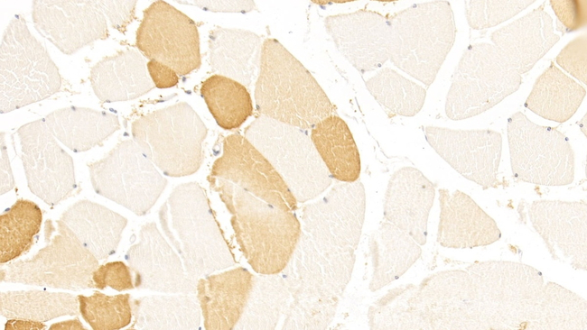 LSR Antibody in Immunohistochemistry (Paraffin) (IHC (P))