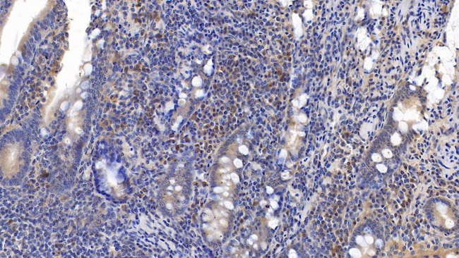 CD3d Antibody in Immunohistochemistry (Paraffin) (IHC (P))