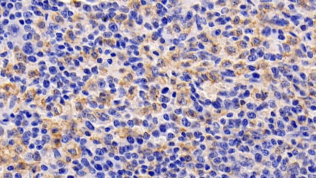 TSLP Antibody in Immunohistochemistry (Paraffin) (IHC (P))
