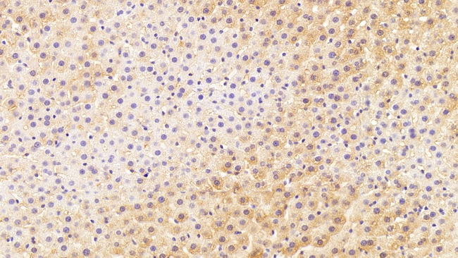 HPD Antibody in Immunohistochemistry (Paraffin) (IHC (P))