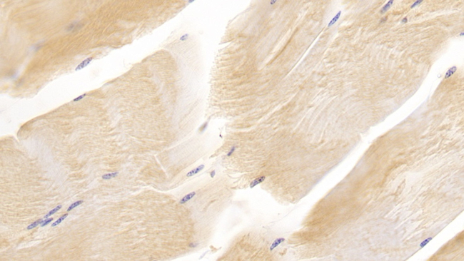 CD90 Antibody in Immunohistochemistry (Paraffin) (IHC (P))