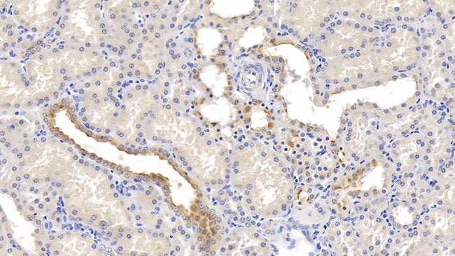Nectin 2 Antibody in Immunohistochemistry (Paraffin) (IHC (P))