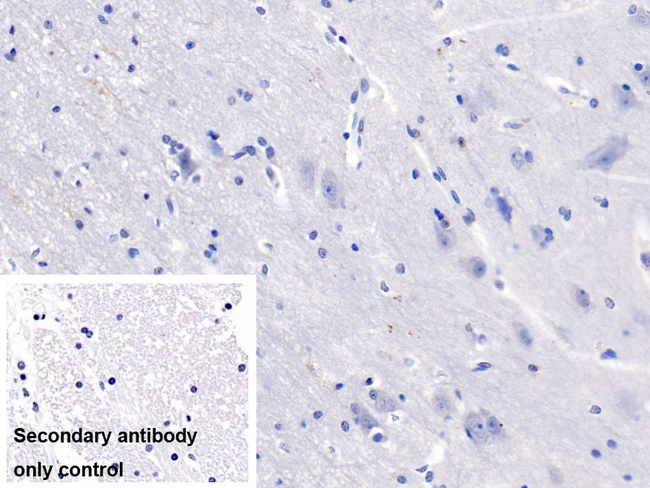 COL5A2 Antibody in Immunohistochemistry (Paraffin) (IHC (P))