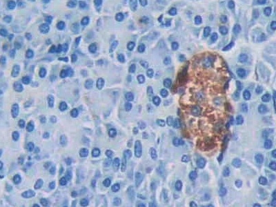 Cathelicidin Antibody in Immunohistochemistry (Paraffin) (IHC (P))