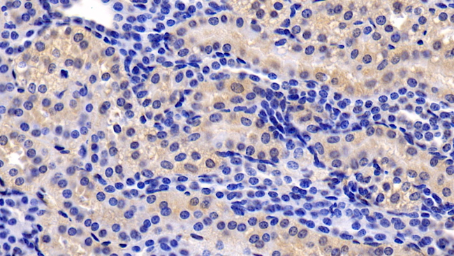 TSLP Antibody in Immunohistochemistry (Paraffin) (IHC (P))