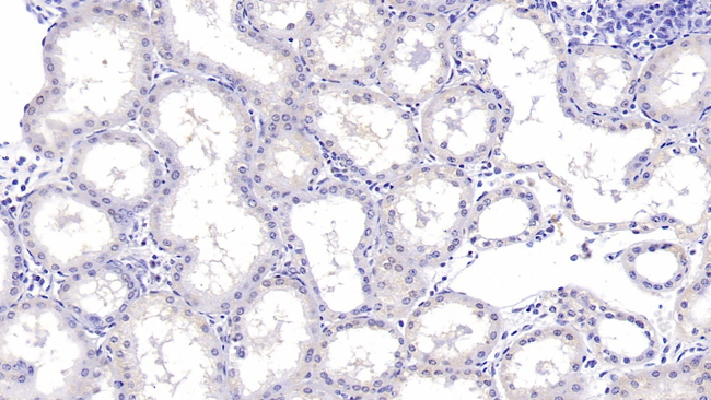AHSP Antibody in Immunohistochemistry (Paraffin) (IHC (P))