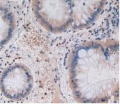 GIP Antibody in Immunohistochemistry (Paraffin) (IHC (P))