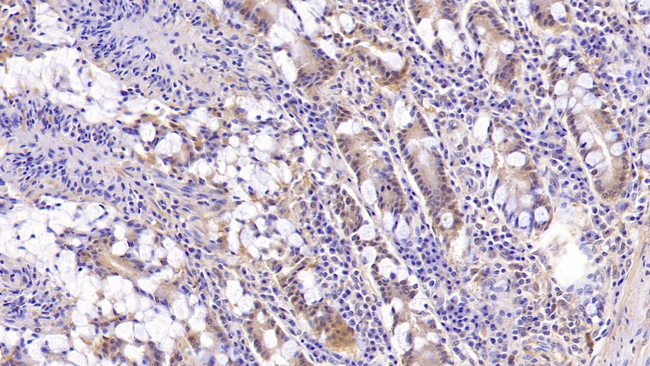 MUC5B Antibody in Immunohistochemistry (Paraffin) (IHC (P))