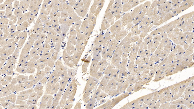 Myosin 4 Antibody in Immunohistochemistry (Paraffin) (IHC (P))
