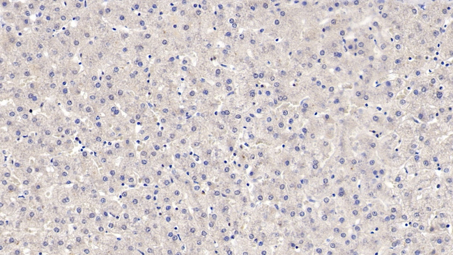 NAMPT Antibody in Immunohistochemistry (Paraffin) (IHC (P))