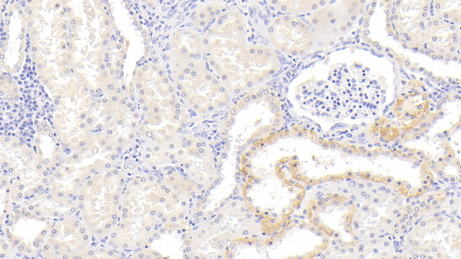 INHBB Antibody in Immunohistochemistry (Paraffin) (IHC (P))