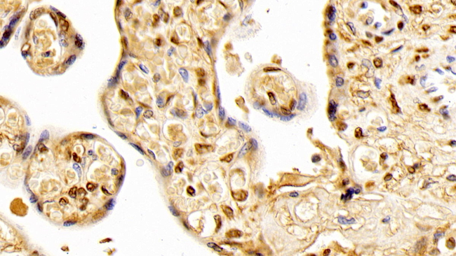 AHR Antibody in Immunohistochemistry (Paraffin) (IHC (P))