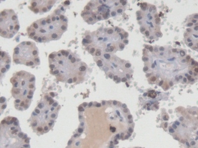 EGR1 Antibody in Immunohistochemistry (Paraffin) (IHC (P))