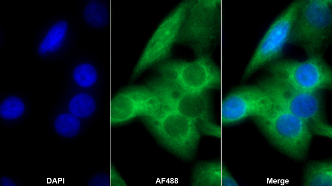 PKC epsilon Antibody in Immunocytochemistry (ICC/IF)