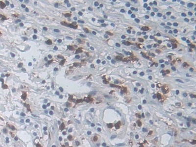 IL-19 Antibody in Immunohistochemistry (Paraffin) (IHC (P))