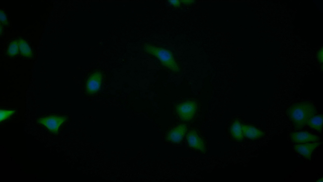 S100A6 Antibody in Immunocytochemistry (ICC/IF)