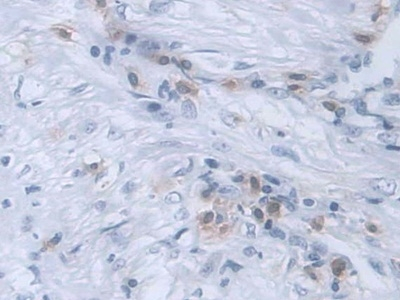 RANK Antibody in Immunohistochemistry (Paraffin) (IHC (P))
