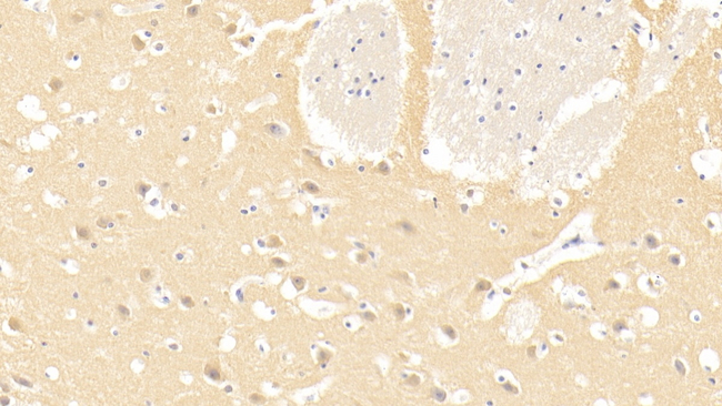 Laminin alpha-3 Antibody in Immunohistochemistry (Paraffin) (IHC (P))
