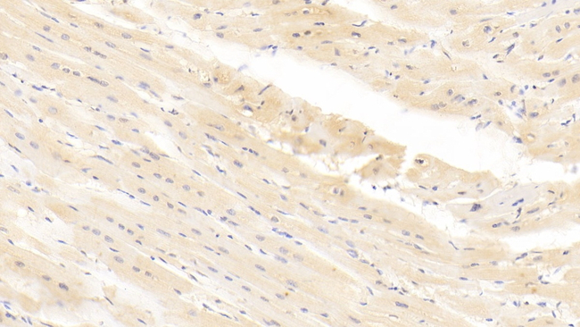 ITGA11 Antibody in Immunohistochemistry (Paraffin) (IHC (P))