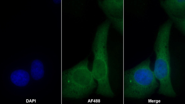 Caspase 6 Antibody in Immunocytochemistry (ICC/IF)
