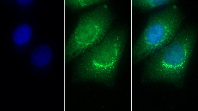 PSAP Antibody in Immunocytochemistry (ICC/IF)