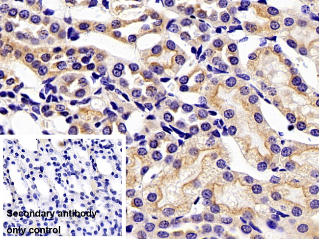 GCKR Antibody in Immunohistochemistry (Paraffin) (IHC (P))