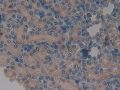 A1BG Antibody in Immunohistochemistry (Paraffin) (IHC (P))