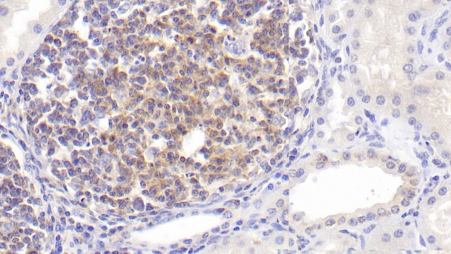 IL-2 Antibody in Immunohistochemistry (Paraffin) (IHC (P))