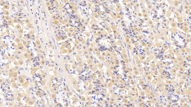 IL-5 Antibody in Immunohistochemistry (Paraffin) (IHC (P))
