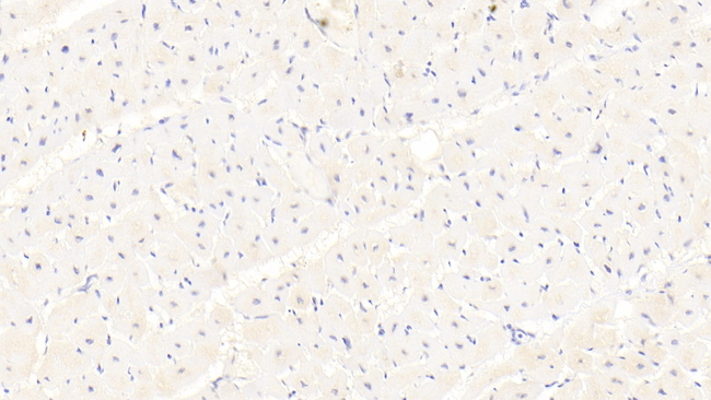 SRC3 Antibody in Immunohistochemistry (Paraffin) (IHC (P))