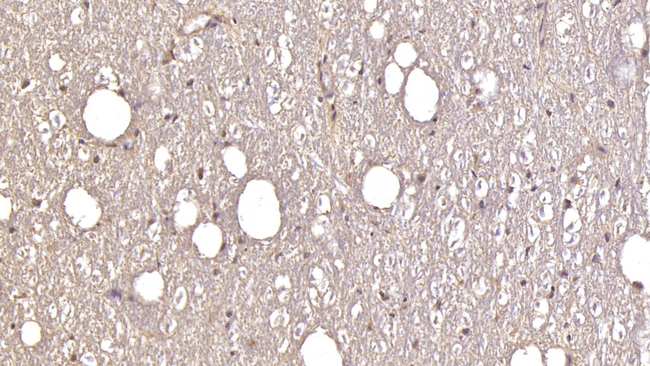 GluR2 Antibody in Immunohistochemistry (Paraffin) (IHC (P))