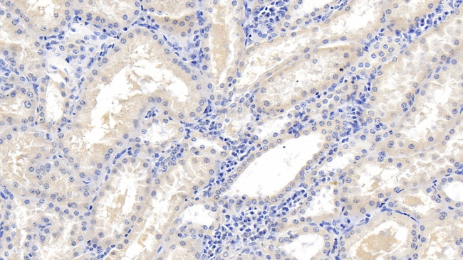 EB1 Antibody in Immunohistochemistry (Paraffin) (IHC (P))