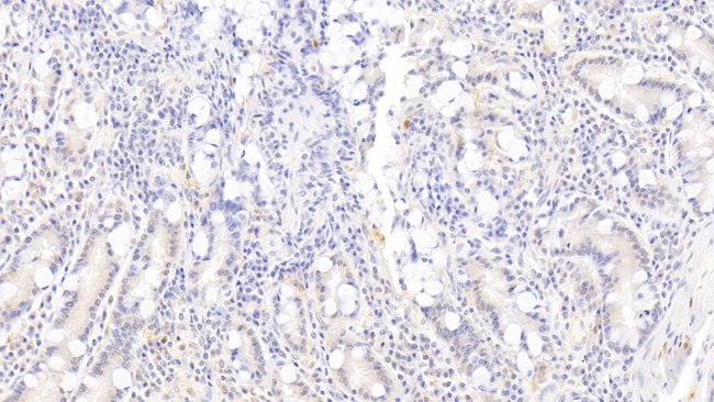RAC1 Antibody in Immunohistochemistry (Paraffin) (IHC (P))