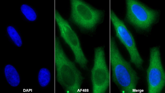 Creatine Kinase MM Antibody in Immunocytochemistry (ICC/IF)