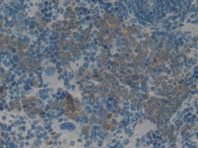 SERPINB2 Antibody in Immunohistochemistry (Paraffin) (IHC (P))