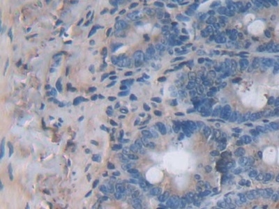 IL24 Antibody in Immunohistochemistry (Paraffin) (IHC (P))