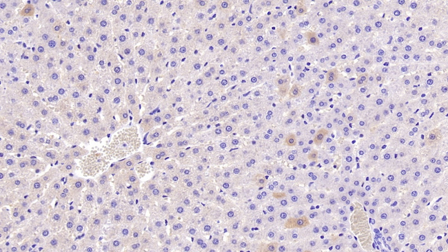 CAT1 Antibody in Immunohistochemistry (Paraffin) (IHC (P))
