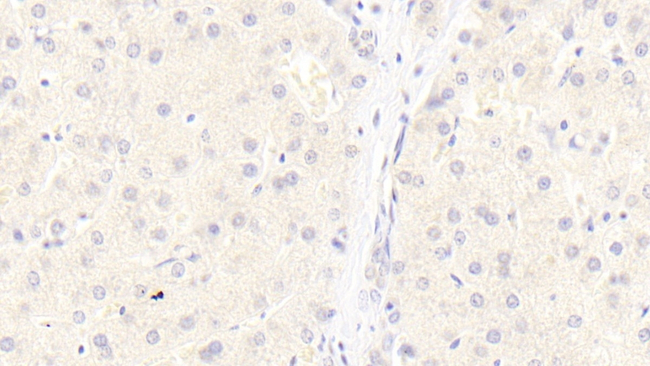 LRP6 Antibody in Immunohistochemistry (Paraffin) (IHC (P))