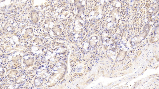 Monoacylglycerol Lipase Antibody in Immunohistochemistry (Paraffin) (IHC (P))