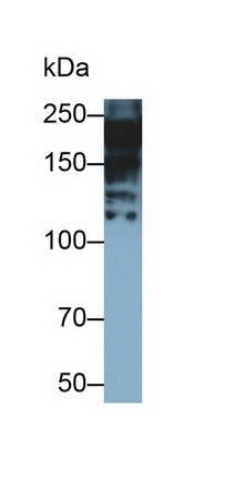 MYH7 Antibody in Western Blot (WB)