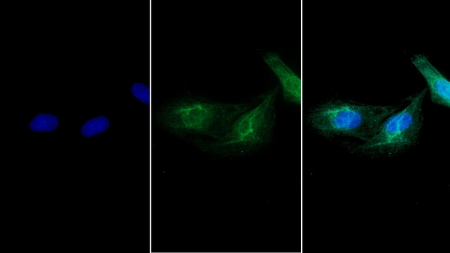 MYH8 Antibody in Immunocytochemistry (ICC/IF)