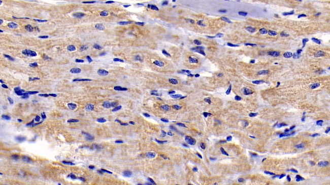 BAI3 Antibody in Immunohistochemistry (Paraffin) (IHC (P))