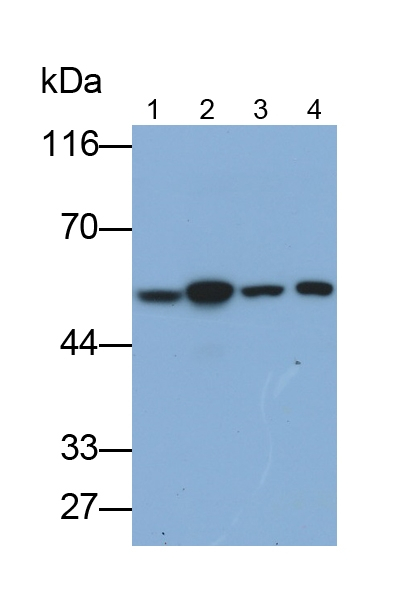 FKBP8 Antibody in Western Blot (WB)